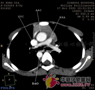 �΄��}��Mխ
